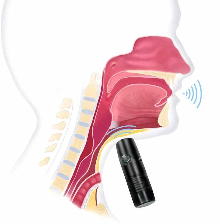 Diagram of an electrolarynx held against the neck, sending sound into the mouth.